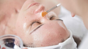 peeling enzymatyczny i kwasowy